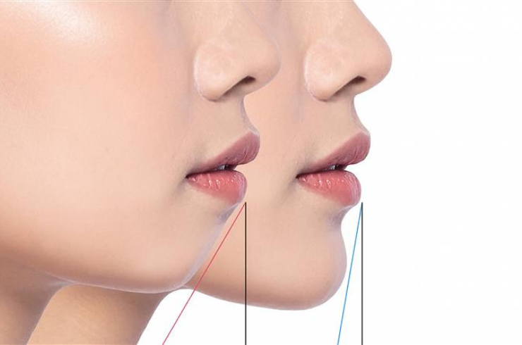 Maxillofacial Surgeries